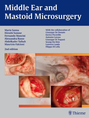 cover image of Middle Ear and Mastoid Microsurgery